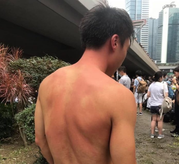 JOURNALISTE ASPERGÉ DE GAZ POIVRE