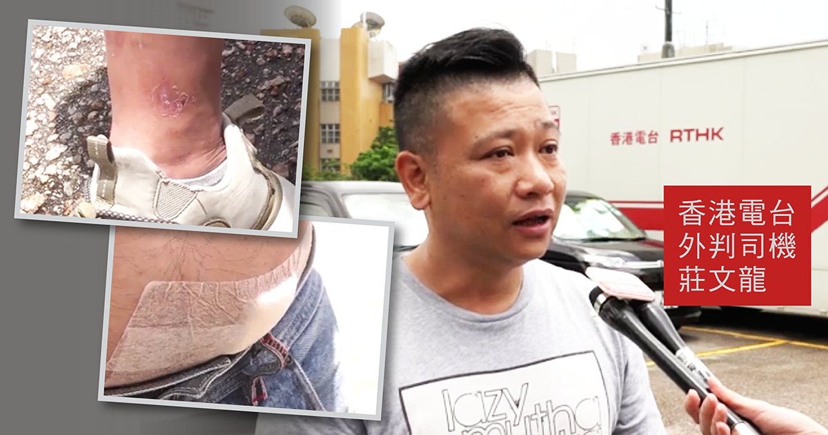 港台司機被催淚彈擊中致暈倒