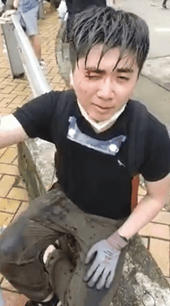 Aimed and fired rubber bullet directly at protester’s head (2)