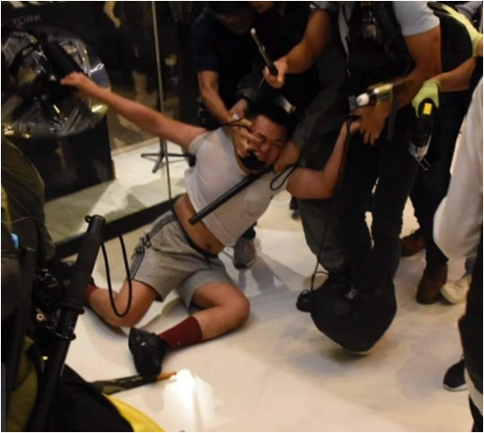 Torturous eye stabbing during arrest of protesters
