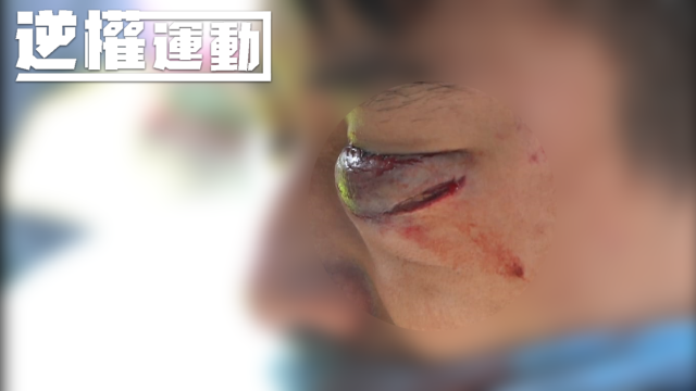 瞄準抗爭者頭部 開槍發射橡膠子彈