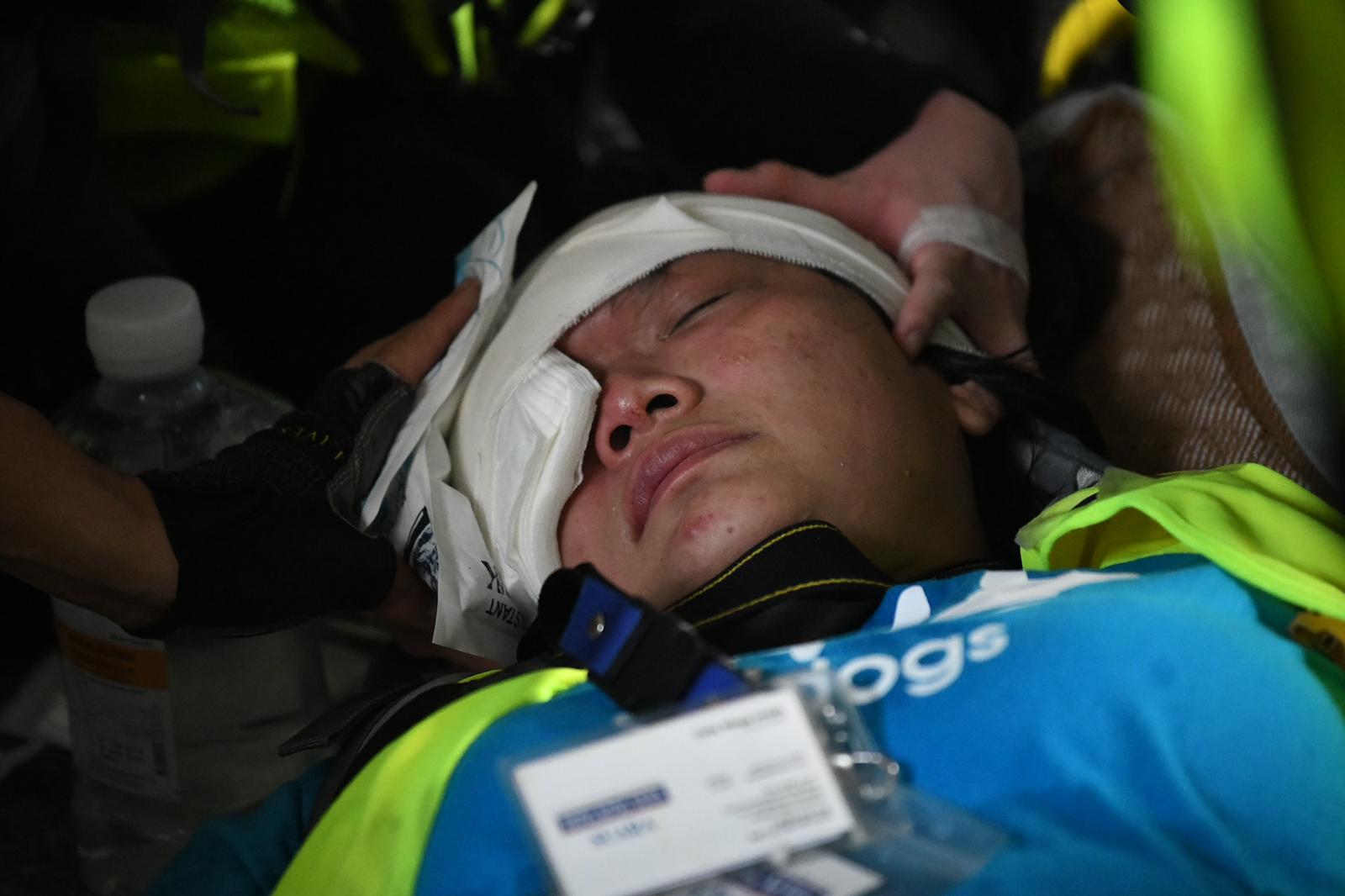 2019.09.29 印尼女記者右眼永久失明  律師：遭警橡膠子彈射爆