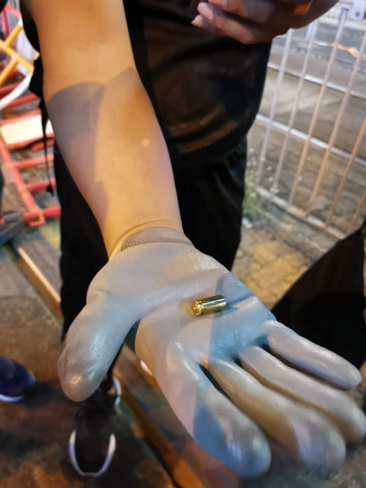 2019.10.04 元朗14歲少年腳部中槍 留醫情況穩定 防暴警駐守病房外