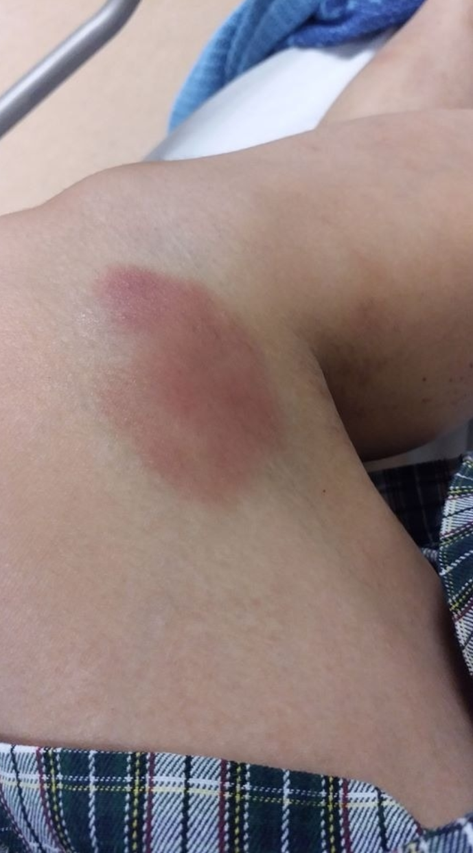 마스크 쓰는 여자가 신분증 없어서 종죄범 듯이 체포, 무릎으로 허벅지 및 허리를 누르며 쇠줄로 묶이고