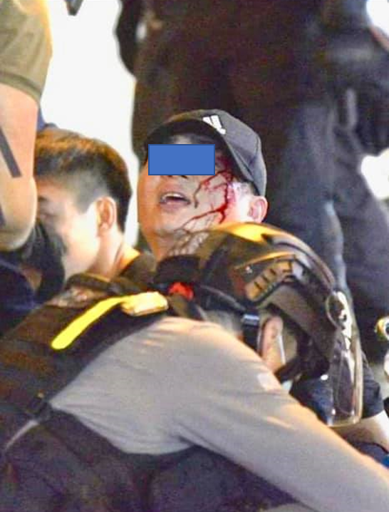 Conflict on the 7th month commemorate of 8.31. Protesters were arrested, beaten, and covered in blood