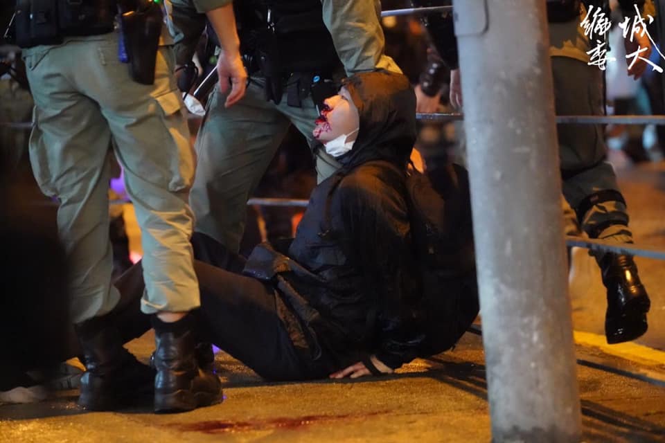 Arrestee beaten to a pulp 7 months after 831 Incident