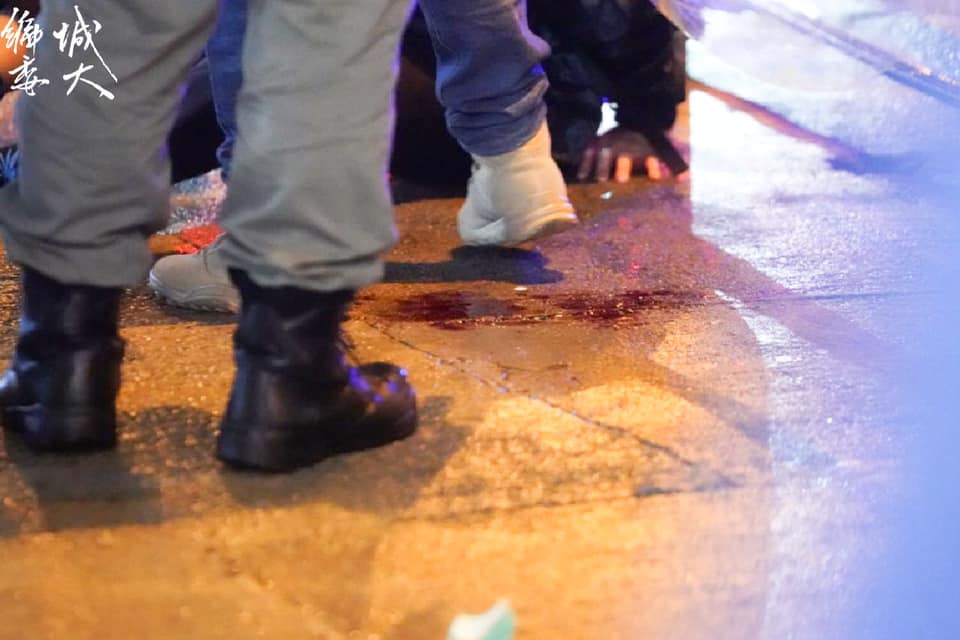 Arrestee beaten to a pulp 7 months after 831 Incident