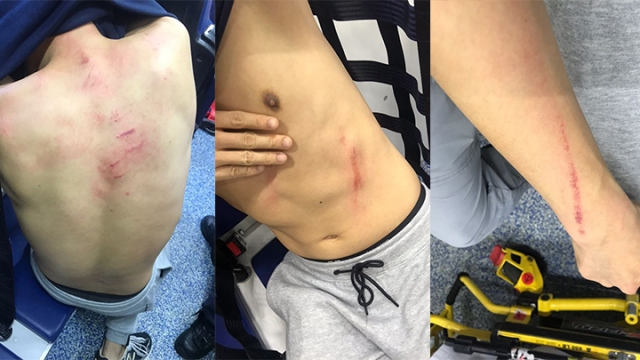 Blue ribbon fanatics who support Article 23 assaulting dissenting passers-by whose cell phones were thrown and damaged and yet no one was arrested