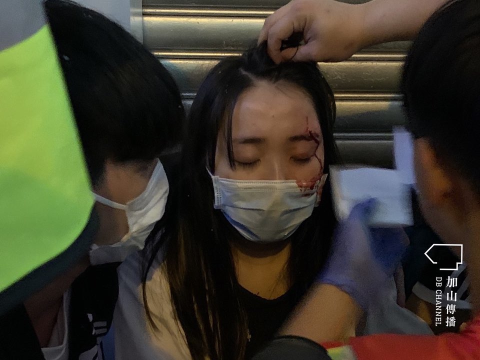 Civilian gets hit in eye by rubble from police forcing car past roadblocks