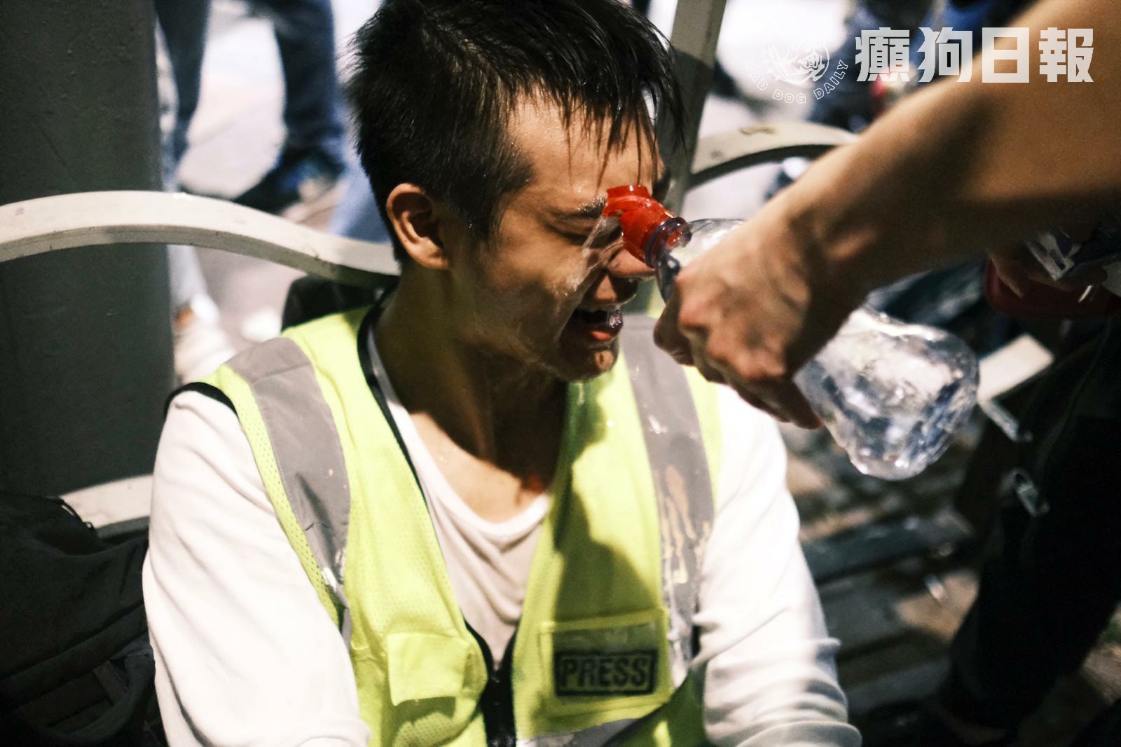 Riot Police described journalist from the Stand News as “cockroach” and intentionally pepper-sprayed him